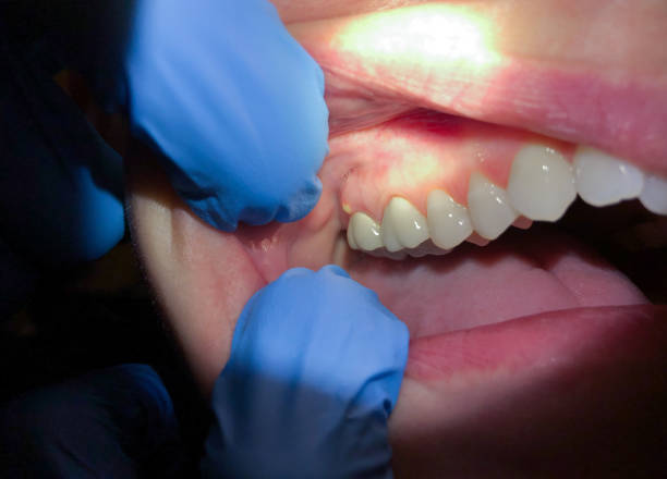 Best Emergency Dental Services for Seniors in Woodlynne, NJ
